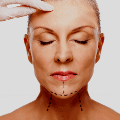 أنواع عملية شد الرقبة في تركيا